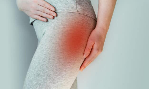 How to sleep more comfortably with piriformis syndrome