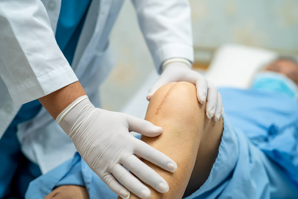How long after a knee replacement should you wait to start PT? asian senior woman patient show her scars surgical 2023 11 27 05 29 14 utc how long after a knee replacement should you wait to start pt? neck pain