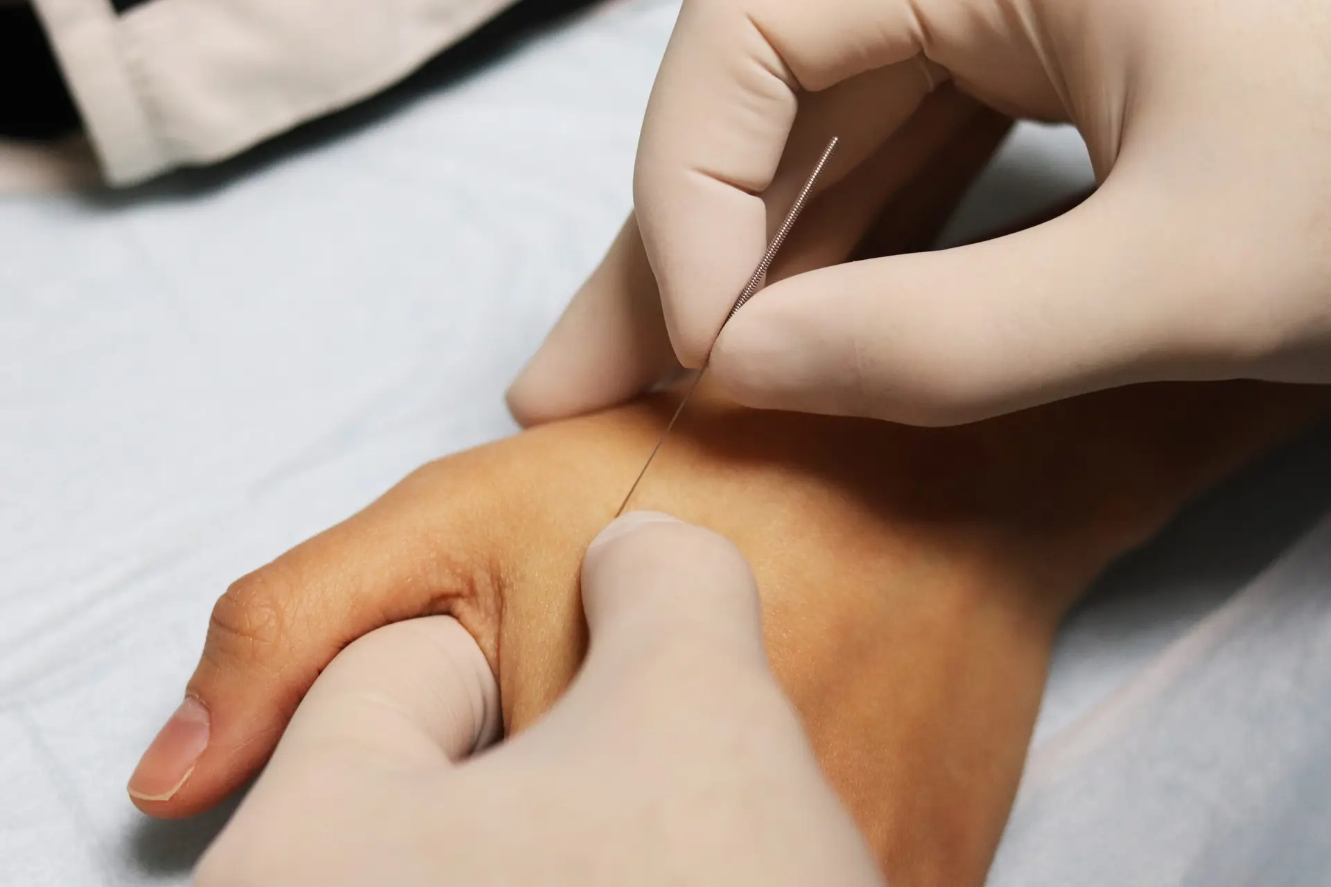 The value that dry needling brings to your practice shutterstock 1469956748 scaled The value that dry needling brings to your practice