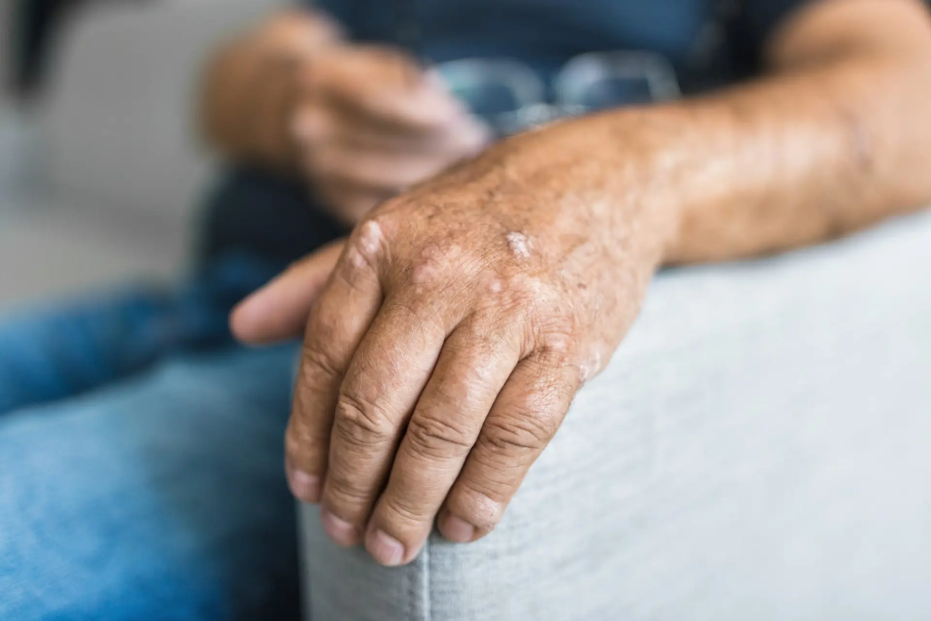 Physical Therapy for Every Type of Arthritis